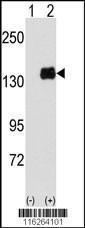 Anti-PUM1 Rabbit Polyclonal Antibody (HRP (Horseradish Peroxidase))