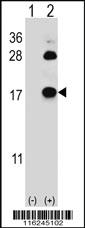 Anti-FABP4 Rabbit Polyclonal Antibody