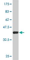 Anti-SMARCB1 Mouse Monoclonal Antibody [clone: 3E3]