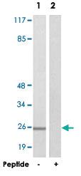 Anti-AKIP1 Rabbit Polyclonal Antibody