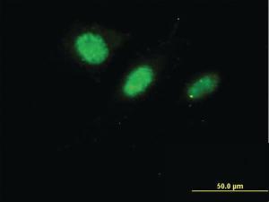 Anti-DNAJC7 Mouse Monoclonal Antibody [clone: 4G6-G3]