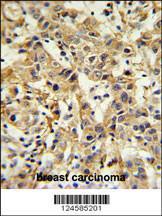 Anti-CA6 Rabbit Polyclonal Antibody (FITC (Fluorescein Isothiocyanate))