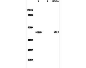 Anti-ADRB2 Rabbit Polyclonal Antibody