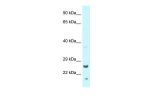 Anti-TK1 Rabbit Polyclonal Antibody