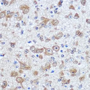 Immunohistochemistry analysis of paraffin-embedded mouse brain using Anti-HuD Antibody (A8714) at dilution of 100 (40x lens). Perform microwave antigen retrieval with 10 mM PBS buffer pH 7.2 before commencing with IHC staining protocol.