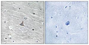 Immunohistochemical analysis of paraffin-embedded human brain tissue using Anti-VHL Antibody. The right hand panel represents a negative control, where the Antibody was pre-incubated with the immunising peptide