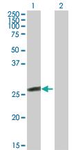 Anti-GSTK1 Mouse Polyclonal Antibody