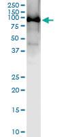 Anti-MYB Polyclonal Antibody Pair