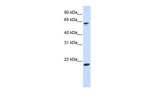 Anti-APRT Rabbit Polyclonal Antibody