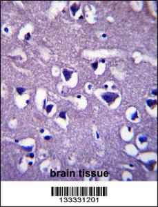 Anti-CCDC117 Rabbit Polyclonal Antibody (FITC (Fluorescein Isothiocyanate))