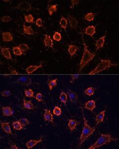 Immunofluorescence analysis of HUVEC cells using Anti-CD44 Antibody (A309094) at a dilution of 1:100. DAPI was used to stain the cell nuclei (blue).