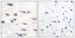 Immunohistochemical analysis of paraffin-embedded human brain using Anti-Trk A (phospho Tyr791) Antibody. The right hand panel represents a negative control, where the antibody was pre-incubated with the immunising peptide