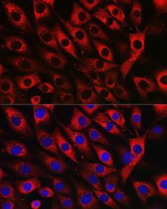 Anti-UFL1 Rabbit Polyclonal Antibody