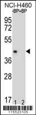 Anti-MBP Rabbit Polyclonal Antibody