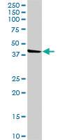 Anti-POMK Rabbit Polyclonal Antibody