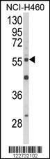 Anti-AKT2 Rabbit Polyclonal Antibody (Biotin)