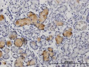 Anti-MMP1 Rabbit Polyclonal Antibody