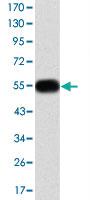 Anti-MMP9 Mouse Monoclonal Antibody [clone: 5C3]