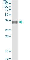 Anti-PRSS8 Antibody Pair