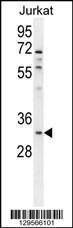 Anti-OR5B12 Rabbit Polyclonal Antibody (FITC (Fluorescein Isothiocyanate))