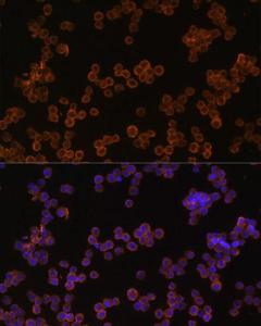 Immunofluorescence analysis of Raw264. 7 cells using Anti-CD44 Antibody (A309094) at a dilution of 1:100. DAPI was used to stain the cell nuclei (blue).