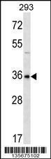 Anti-GBX1 Rabbit Polyclonal Antibody (APC (Allophycocyanin))