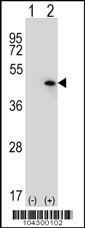 Anti-USP12 Rabbit Polyclonal Antibody (AP (Alkaline Phosphatase))