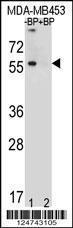 Anti-TOX3 Rabbit Polyclonal Antibody (PE (Phycoerythrin))