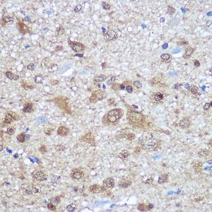 Immunohistochemistry analysis of paraffin-embedded rat brain using Anti-HuD Antibody (A8714) at dilution of 100 (40x lens). Perform microwave antigen retrieval with 10 mM PBS buffer pH 7.2 before commencing with IHC staining protocol.