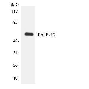 Western blot analysis of the lysates from 293 cells using Anti-TAIP-12 Antibody