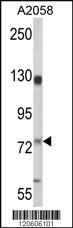 Anti-MCAM Rabbit Polyclonal Antibody