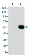 Anti-MMP9 Mouse Monoclonal Antibody [clone: 5C3]