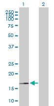 Anti-NMU Mouse Polyclonal Antibody