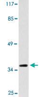 Anti-CYSLTR2 Rabbit Polyclonal Antibody