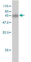 Anti-CDX2 Mouse Monoclonal Antibody [clone: 1C7]