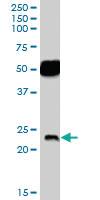 Anti-NRTN Goat Polyclonal Antibody