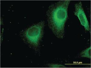 Anti-STAB1 Mouse Monoclonal Antibody [clone: 4G9]