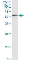 Anti-BBS4 Polyclonal Antibody Pair