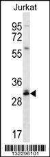 Anti-CTDNEP1 Rabbit Polyclonal Antibody (Biotin)