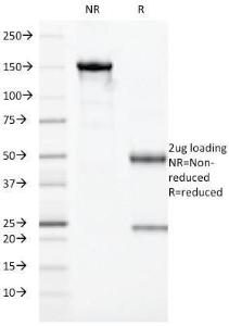 SDS-PAGE analysis of Anti-HLA DRA Antibody [19-26.1] under non-reduced and reduced conditions; showing intact IgG and intact heavy and light chains, respectively. SDS-PAGE analysis confirms the integrity and purity of the antibody