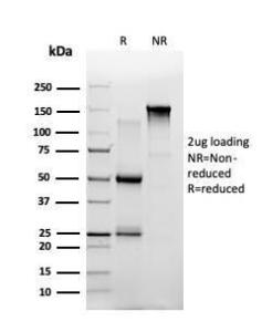 SDS-PAGE analysis of Anti-ThPok Antibody [PCRP-ZBTB7B-1B6] under non-reduced and reduced conditions; showing intact IgG and intact heavy and light chains, respectively. SDS-PAGE analysis confirms the integrity and purity of the antibody