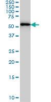 Anti-FARSA Mouse Monoclonal Antibody [clone: 2D8]