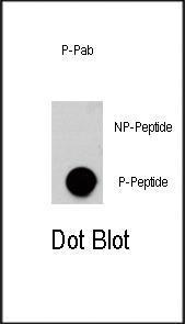 Anti-AKT3 Rabbit Polyclonal Antibody (AP (Alkaline Phosphatase))