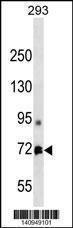 Anti-MTA1 Rabbit Polyclonal Antibody