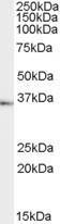 Anti-TACR1 Antibody (A83353) (1 µg/ml) staining of Human Testes lysate (35 µg protein in RIPA buffer). Primary incubation was 1 hour. Detected by chemiluminescence