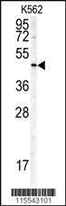 Anti-DCX Rabbit Polyclonal Antibody