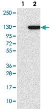 Anti-GARNL3 Rabbit Polyclonal Antibody