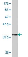 Anti-ENTPD5 Mouse Polyclonal Antibody