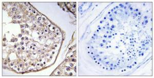 Antibody anti-BAGE3 100 µg