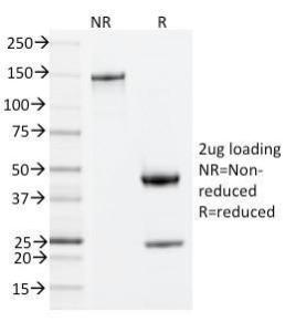 SDS-PAGE analysis of Anti-ZAP70 Antibody [ZAP70/2035] under non-reduced and reduced conditions; showing intact IgG and intact heavy and light chains, respectively SDS-PAGE analysis confirms the integrity and purity of the antibody